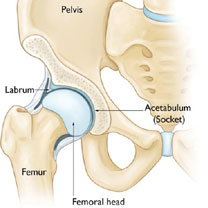 Hip Arthroscopy treatment in Bangalore, Femoroacetabular Impingement Surgery, Labral Repair Bangalore, CAM Osteoplasty, Pincer Osteoplasty, Hip Pain Treatment, FAI Treatment Segehalli, Hip Surgeon KR Puram