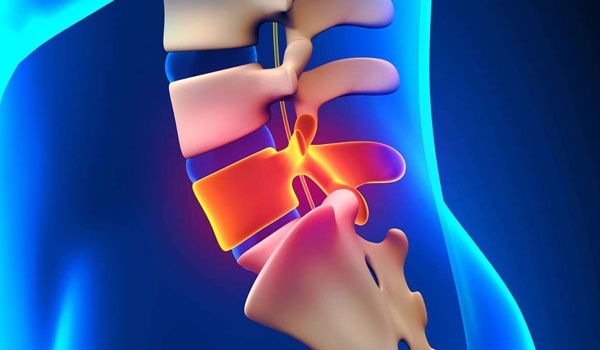 Back and Spine Care in Bangalore, Spine Specialist KR Puram, Slip Disc Treatment Segehalli, Sciatica Treatment Mahadevapura, Spine Injury Doctor Near Me,