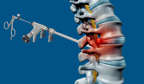 Back and Spine Care in Bangalore, Spine Specialist KR Puram, Slip Disc Treatment Segehalli, Sciatica Treatment Mahadevapura, Spine Injury Doctor Near Me,