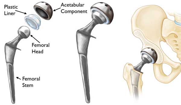 Joint Pain Treatment in Bangalore,Arthritis Specialist in Bangalore,Joint Pain Relief near KR Puram,Arthritis Doctor Seegehalli,Best Arthritis Treatment Bengaluru,Orthopedic Clinic for Joint Pain,Arthritis Clinic Mahadevapura,Joint Pain Management Bangalore,Joint Pain & Arthritis Doctor near me,Arthritis Treatment in Bangalore
