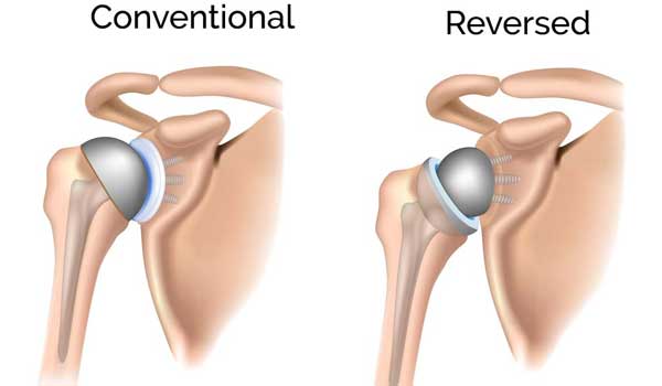 Joint Pain Treatment in Bangalore,Arthritis Specialist in Bangalore,Joint Pain Relief near KR Puram,Arthritis Doctor Seegehalli,Best Arthritis Treatment Bengaluru,Orthopedic Clinic for Joint Pain,Arthritis Clinic Mahadevapura,Joint Pain Management Bangalore,Joint Pain & Arthritis Doctor near me,Arthritis Treatment in Bangalore