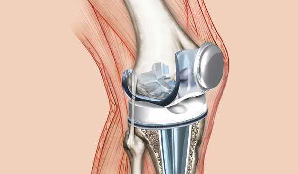Joint Pain Treatment in Bangalore,Arthritis Specialist in Bangalore,Joint Pain Relief near KR Puram,Arthritis Doctor Seegehalli,Best Arthritis Treatment Bengaluru,Orthopedic Clinic for Joint Pain,Arthritis Clinic Mahadevapura,Joint Pain Management Bangalore,Joint Pain & Arthritis Doctor near me,Arthritis Treatment in Bangalore
