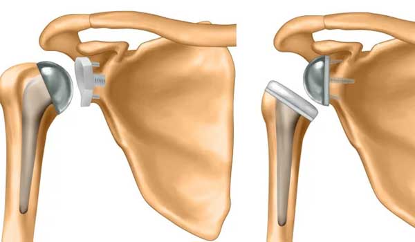 Joint Pain Treatment in Bangalore,Arthritis Specialist in Bangalore,Joint Pain Relief near KR Puram,Arthritis Doctor Seegehalli,Best Arthritis Treatment Bengaluru,Orthopedic Clinic for Joint Pain,Arthritis Clinic Mahadevapura,Joint Pain Management Bangalore,Joint Pain & Arthritis Doctor near me,Arthritis Treatment in Bangalore